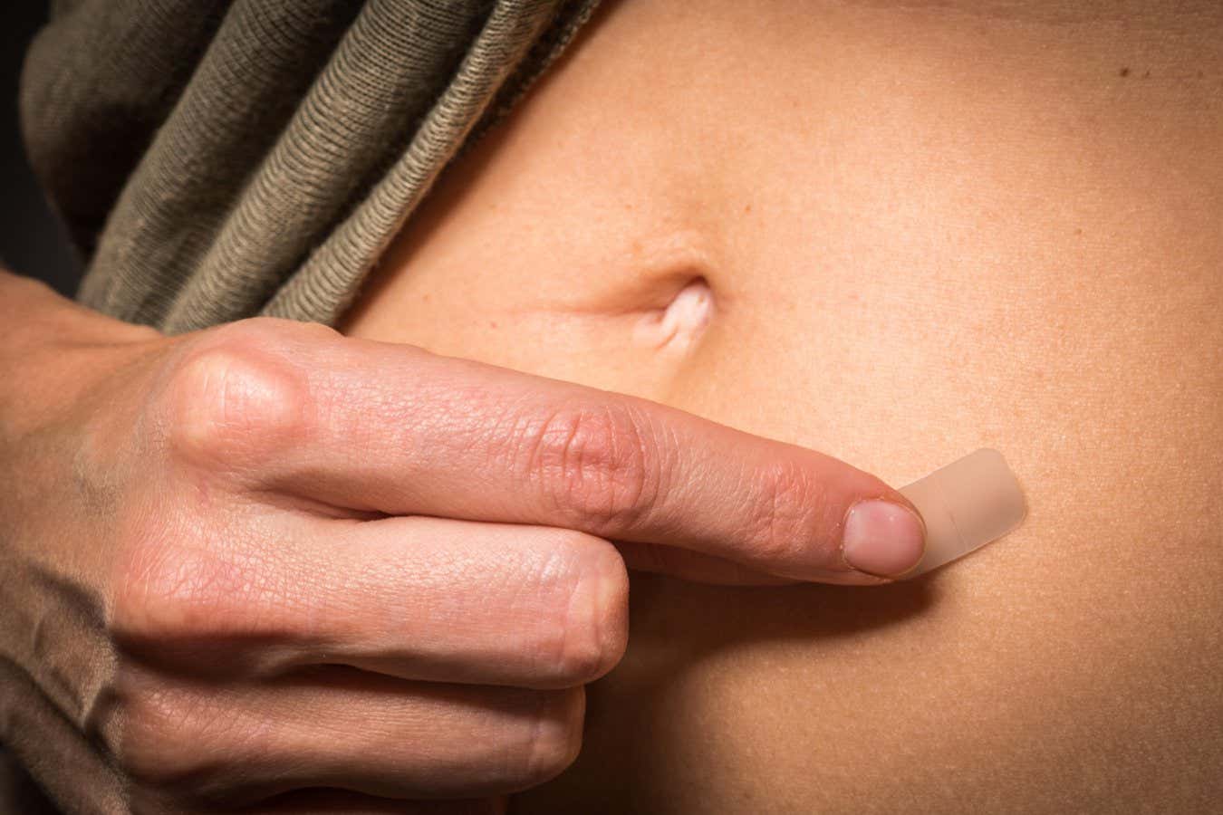 EHNFPG Woman use an oestrogen patch for a Hormone Replacement Therapy (HRT), in order to releive the undesirable effects of menopause.